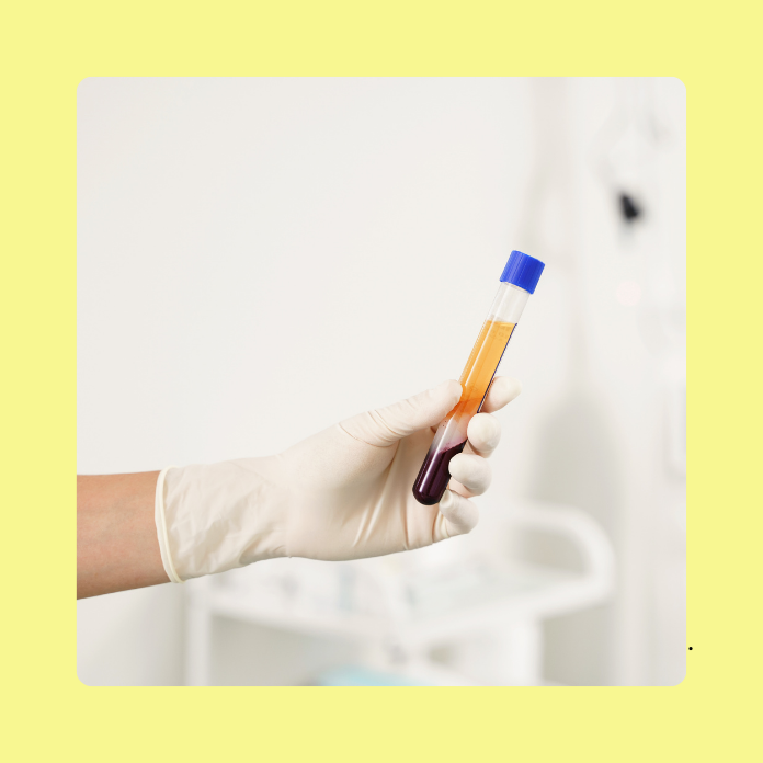 PRP Hair Loss Injection Therapy in Maryland