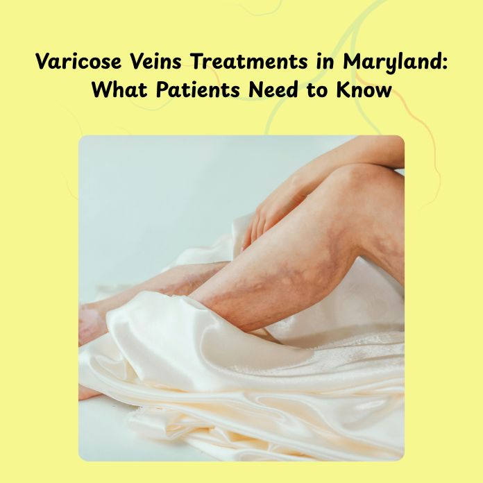 Varicose Veins Treatments
